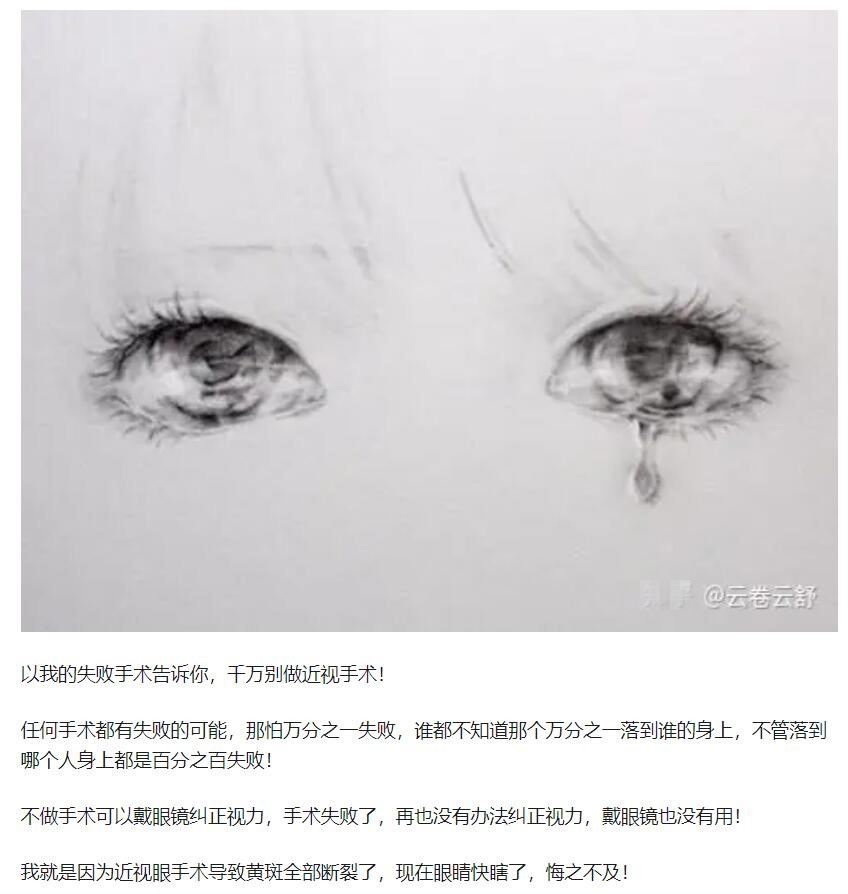 教你，怎樣去了解近視手術(shù)  